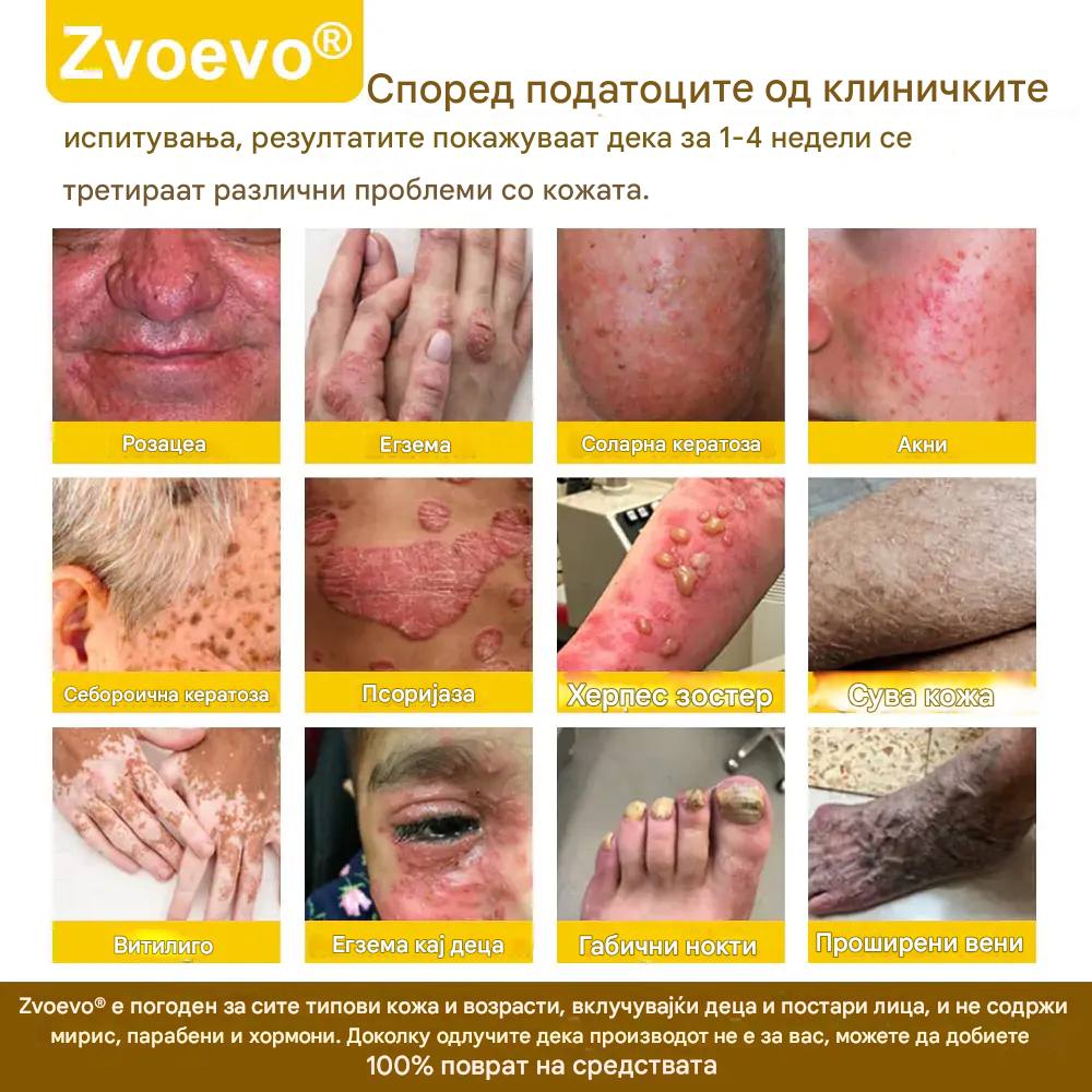 ⚕️𝐳𝐯𝐨𝐞𝐯𝐨® Спреј со Матичен Млеч за Кожа