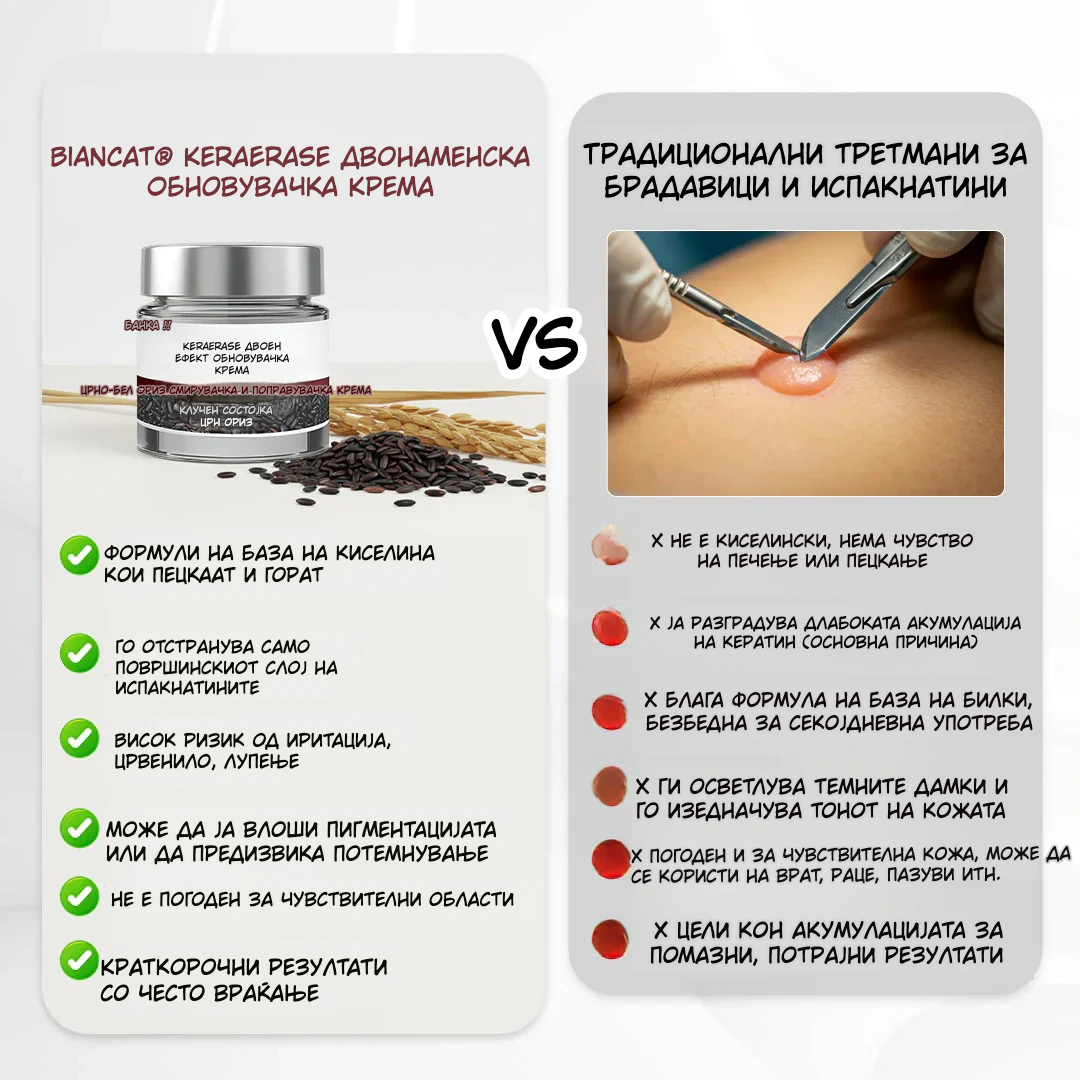 KeraErase Повторно откријте мазна, чиста и убава кожа