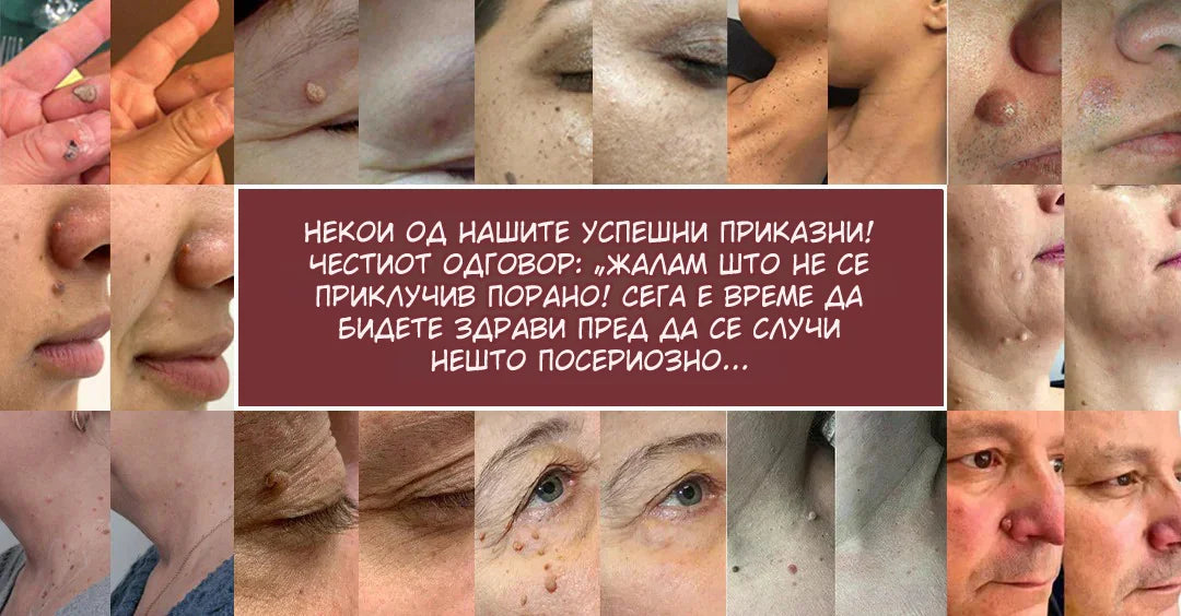 KeraErase Повторно откријте мазна, чиста и убава кожа