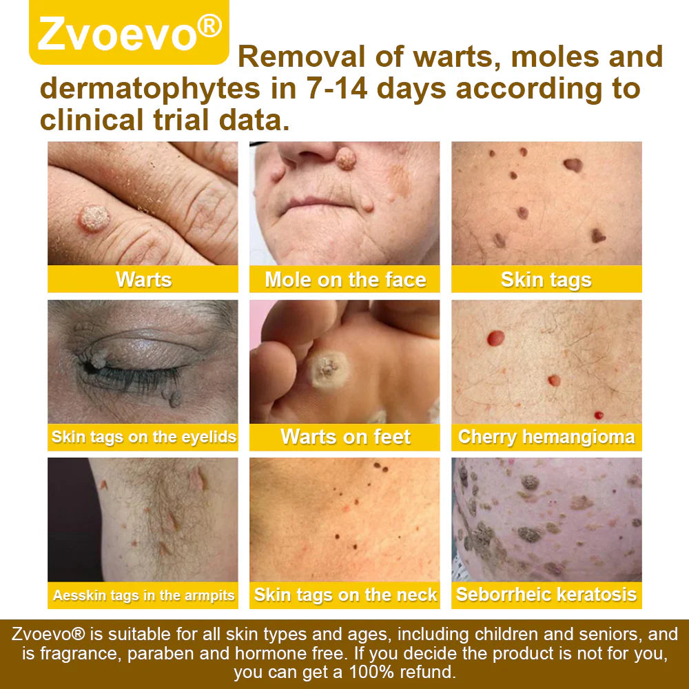 ⚕️𝐳𝐯𝐨𝐞𝐯𝐨® Спреј со Матичен Млеч за Кожа