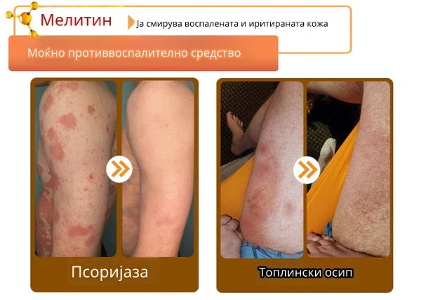 Крем со Матичен Млеч