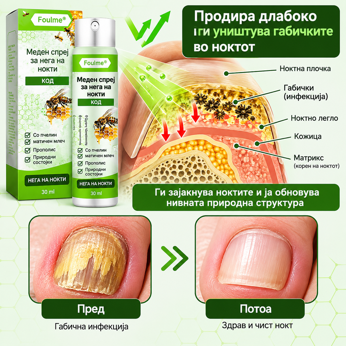 НЕ ГИ КРИЈТЕ ПОВЕЌЕ ВАШИТЕ НОКТИ. FOULME® NailRescueproduct_vendor#100% ЕФИКАСНОНЕ ГИ КРИЈТЕ ПОВЕЌЕ ВАШИТЕ НОКТИ. FOULME® NailRescue# - 100% ЕФИКАСНО