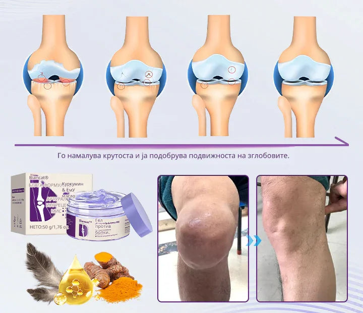 Лековитиот Гел со Куркумин и Емутинско Масло