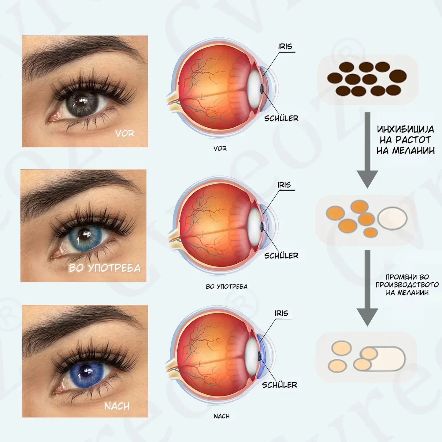 Cvreoz® EyeCandy – Природни капки што ја менуваат бојата на очите за 2 часа (без контактни леќи!)