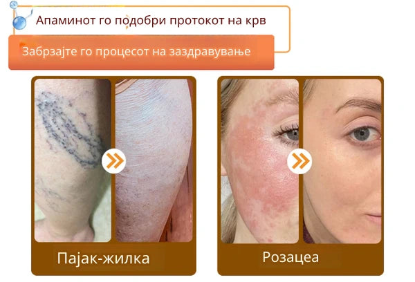 Крем со Матичен Млеч