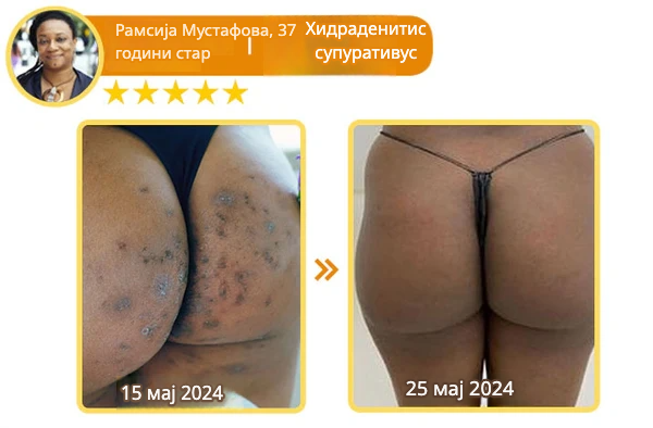 Крем со Матичен Млеч