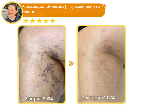 Крем со Матичен Млеч