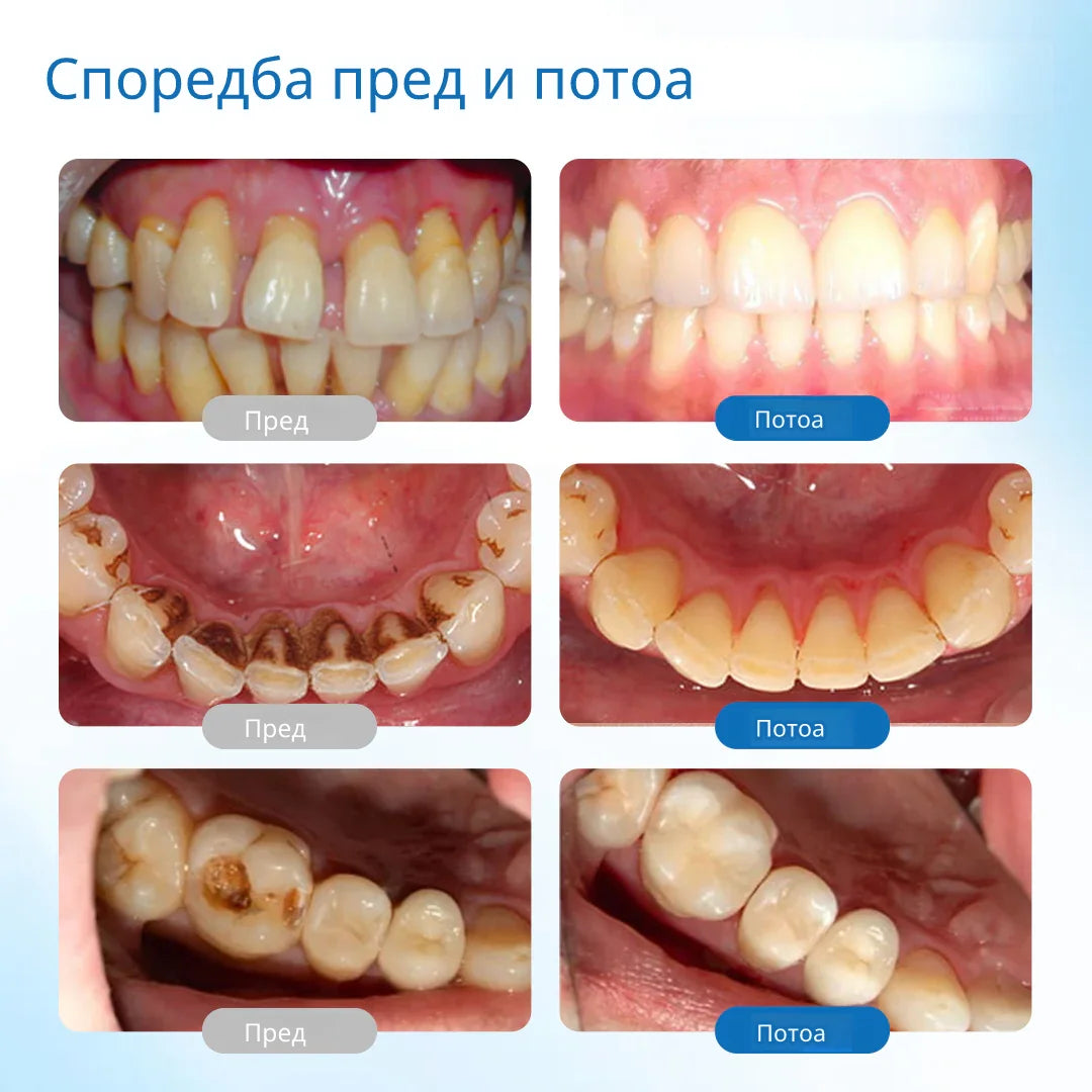 Laleia® NanoHAP Серум за заштита на заби ги пополнува микроскопските оштетувања