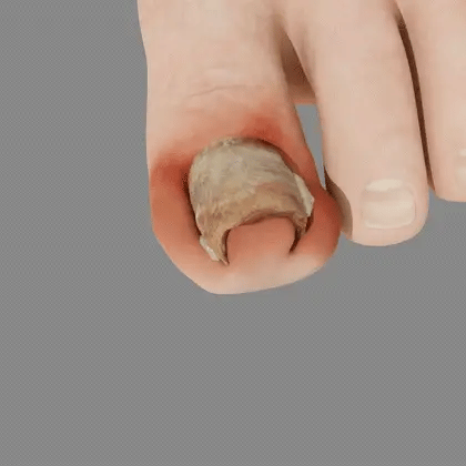 Габите исчезнуваат за 4 недели – природен спреј со матичен млеч!