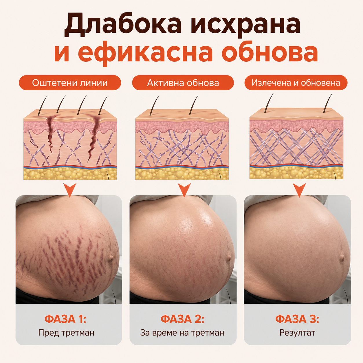 SilkStretch® Премиум Природно Масло против Стрии и Лузни