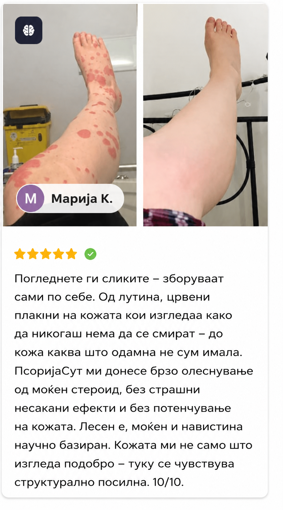 🌿 PsoriaSoothe – Крем за Нега на Кожа Склонa Кон Псоријаза, Егзема и Дерматитис