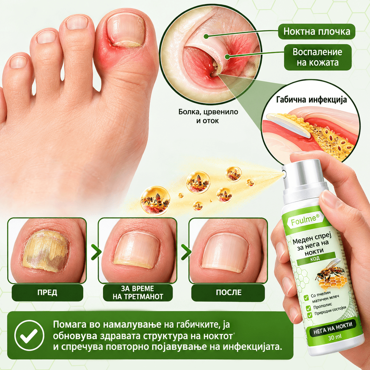 НЕ ГИ КРИЈТЕ ПОВЕЌЕ ВАШИТЕ НОКТИ. FOULME® NailRescueproduct_vendor#100% ЕФИКАСНОНЕ ГИ КРИЈТЕ ПОВЕЌЕ ВАШИТЕ НОКТИ. FOULME® NailRescue# - 100% ЕФИКАСНО