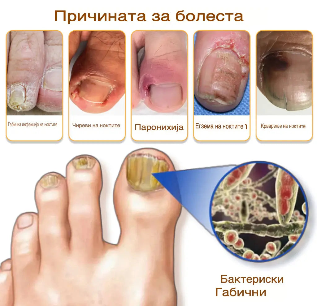 Габите исчезнуваат за 4 недели – природен спреј со матичен млеч!