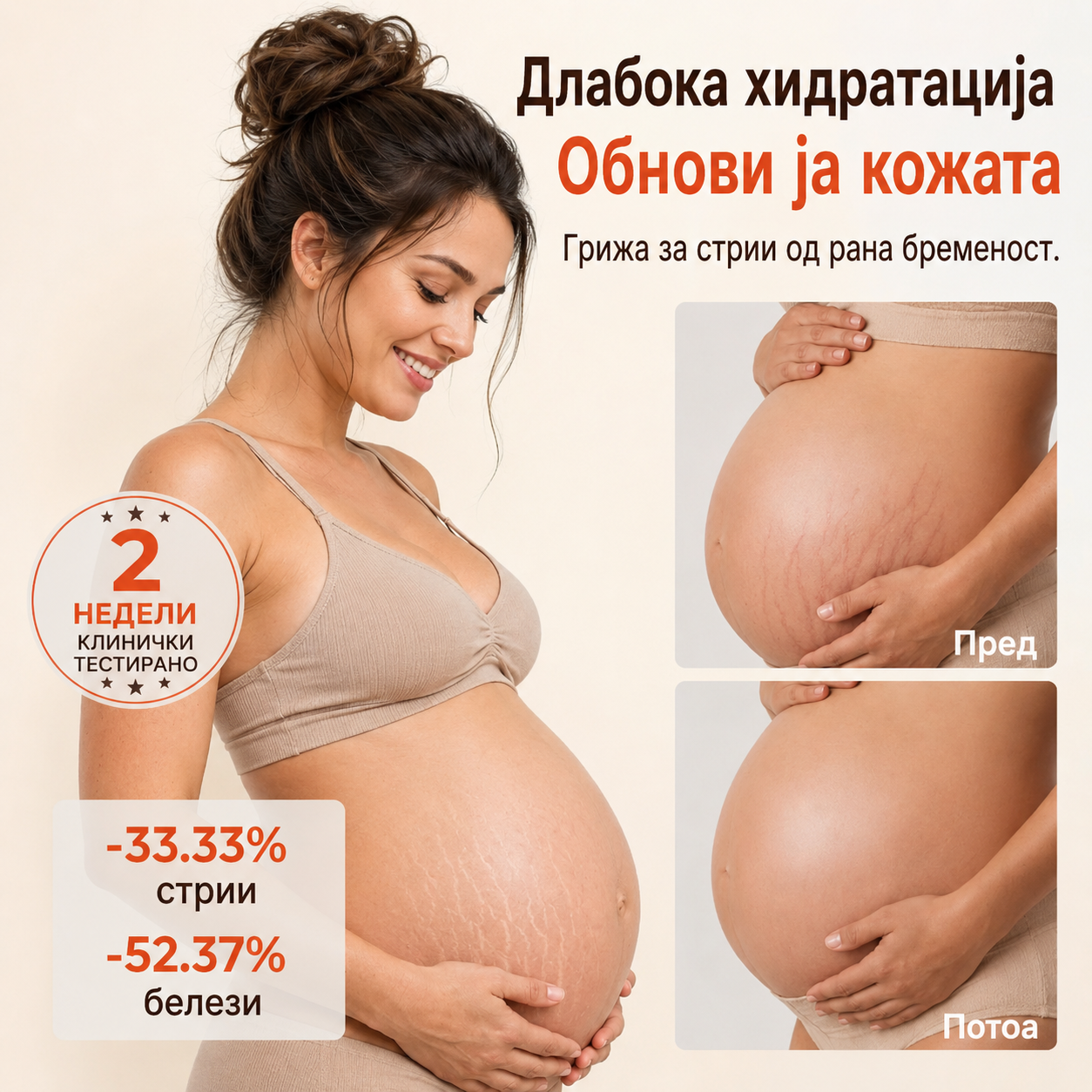 SilkStretch® Премиум Природно Масло против Стрии и Лузни