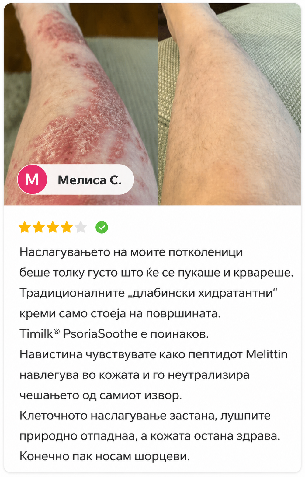 🌿 PsoriaSoothe – Крем за Нега на Кожа Склонa Кон Псоријаза, Егзема и Дерматитис