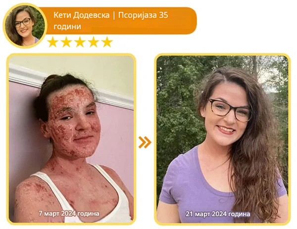 Крем со Матичен Млеч