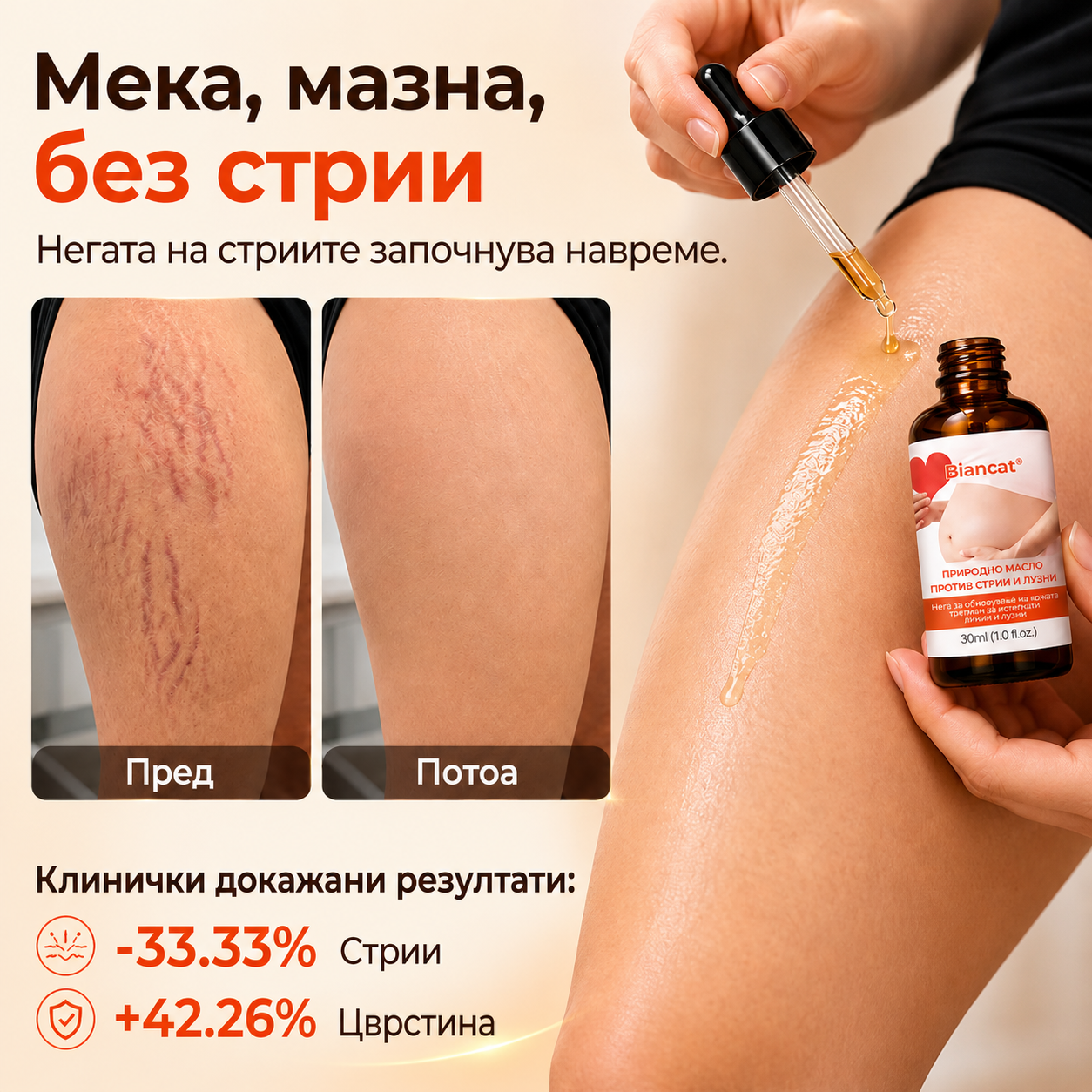 SilkStretch® Премиум Природно Масло против Стрии и Лузни