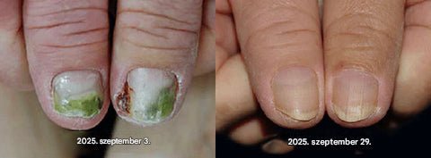 НЕ ГИ КРИЈТЕ ПОВЕЌЕ ВАШИТЕ НОКТИ. FOULME® NailRescueproduct_vendor#100% ЕФИКАСНОНЕ ГИ КРИЈТЕ ПОВЕЌЕ ВАШИТЕ НОКТИ. FOULME® NailRescue# - 100% ЕФИКАСНО