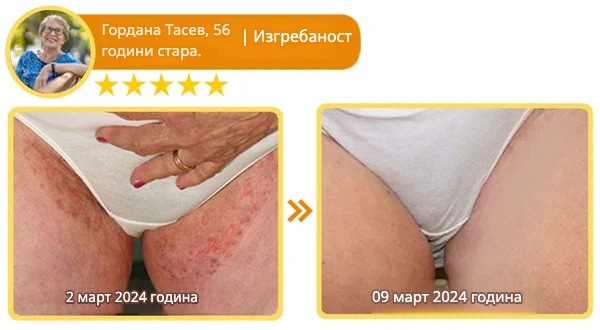 Крем со Матичен Млеч