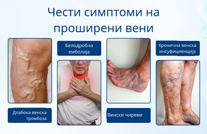 Не Чекај Нозете Да Те Предадат – VenoRelief® Делува Уште Од Прва Апликација 🔥