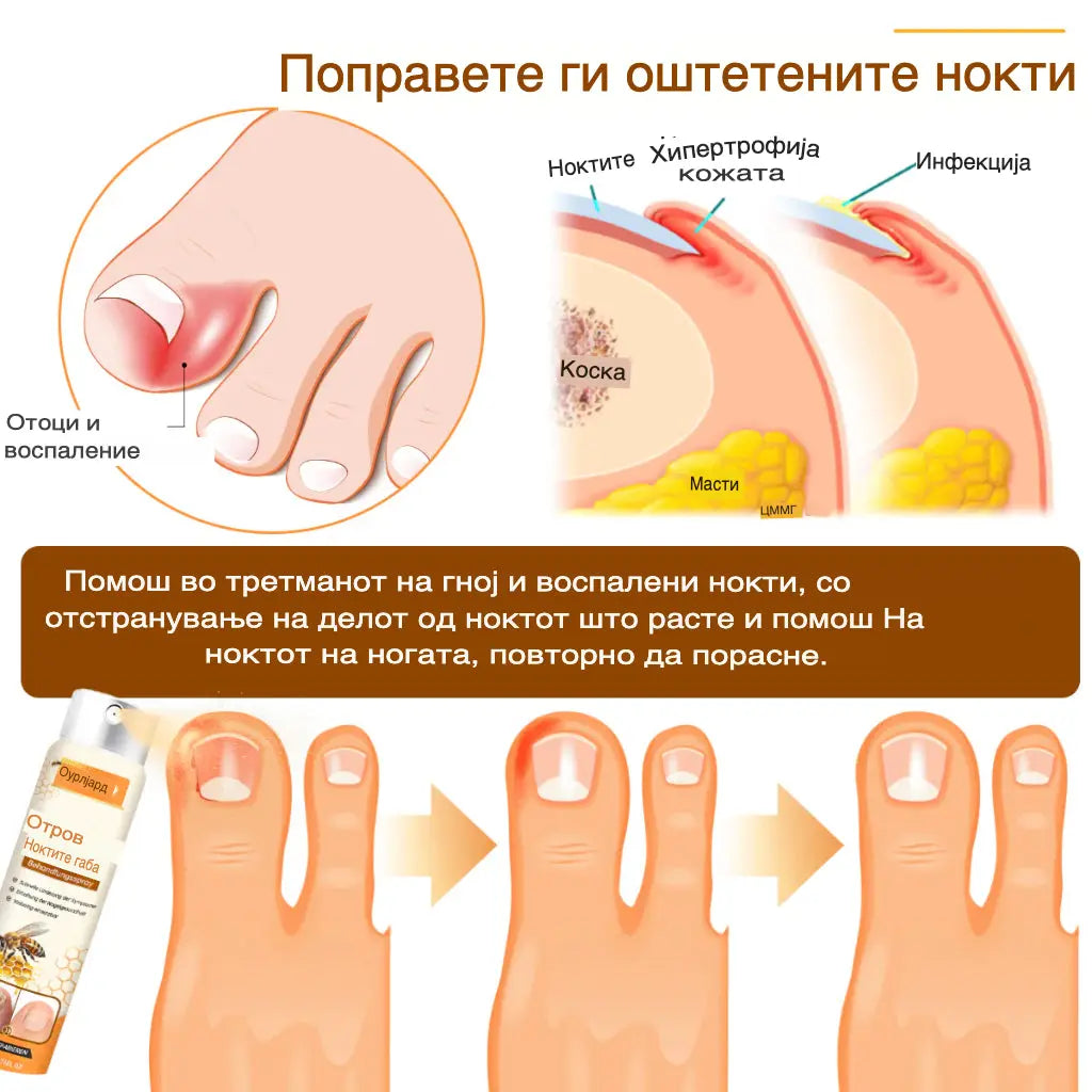 Габите исчезнуваат за 4 недели – природен спреј со матичен млеч!