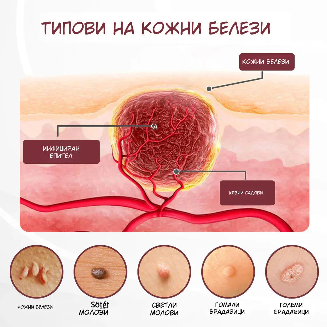KeraErase Повторно откријте мазна, чиста и убава кожа
