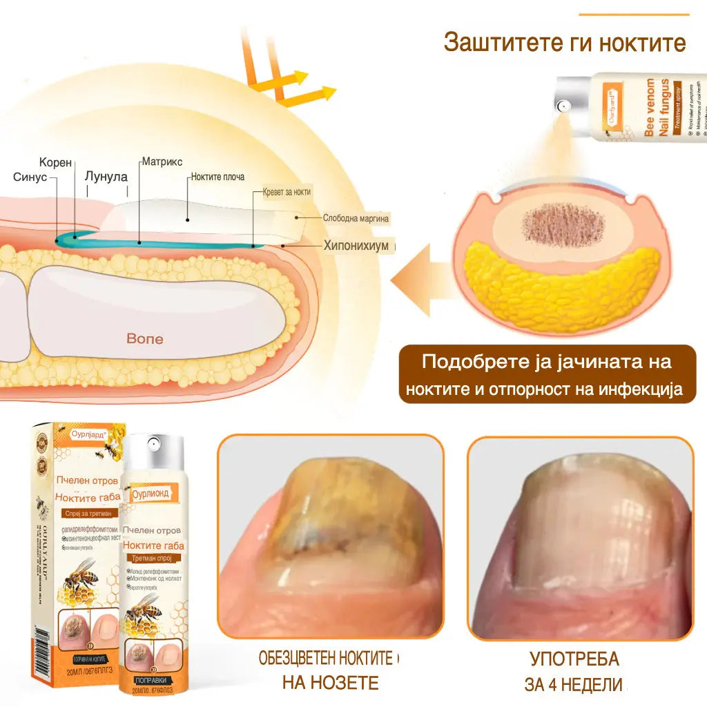 Габите исчезнуваат за 4 недели – природен спреј со матичен млеч!
