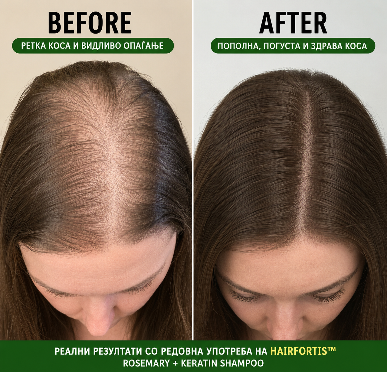 🌿 HairFortis™ Rosemary + Keratin Shampoo