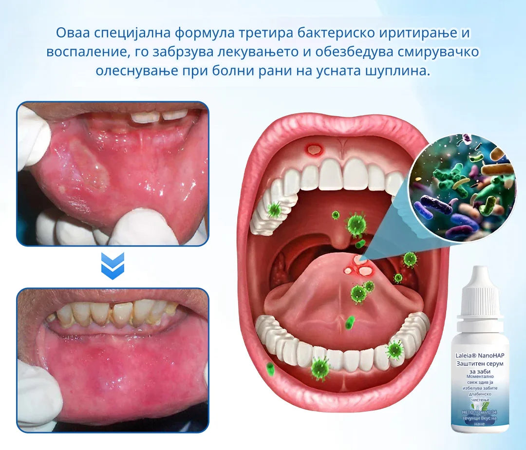 Laleia® NanoHAP Серум за заштита на заби ги пополнува микроскопските оштетувања