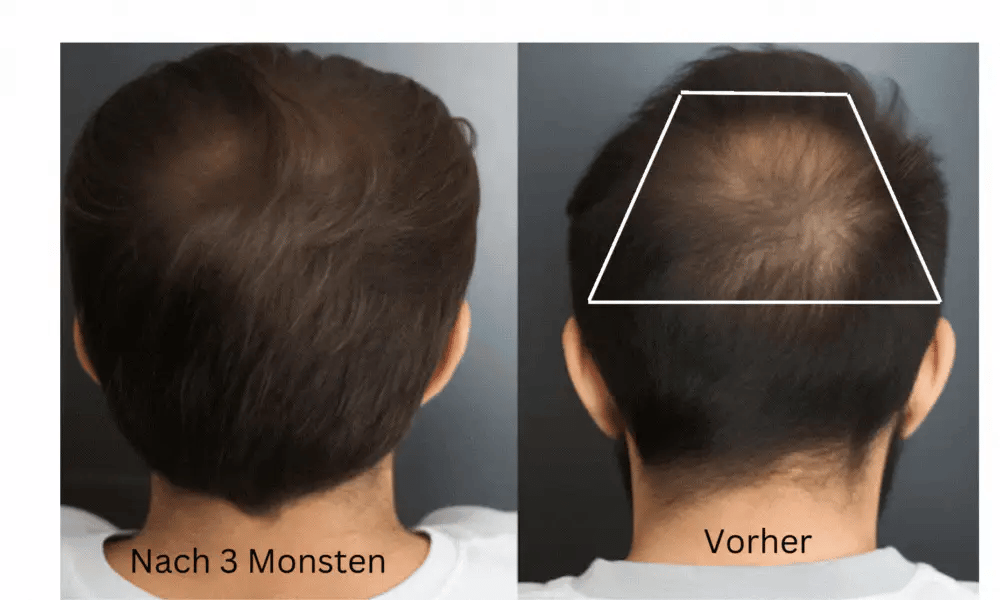 Premium Crveno malso Sprej