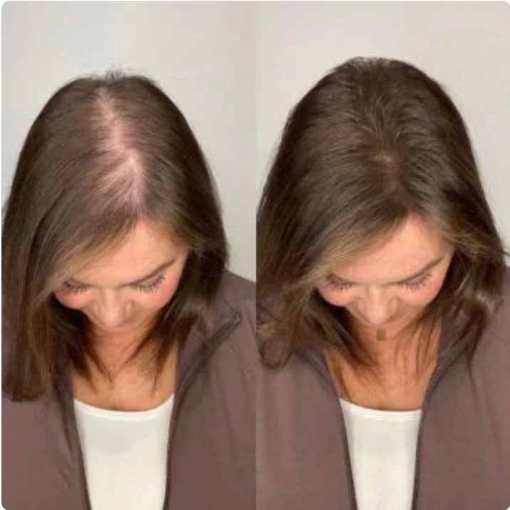 🌿 HairFortis™ Rosemary + Keratin Shampoo
