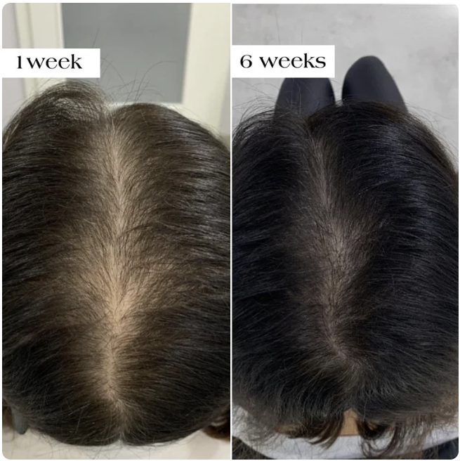 🌿 HairFortis™ Rosemary + Keratin Shampoo