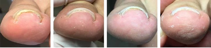 НЕ ГИ КРИЈТЕ ПОВЕЌЕ ВАШИТЕ НОКТИ. FOULME® NailRescueproduct_vendor#100% ЕФИКАСНОНЕ ГИ КРИЈТЕ ПОВЕЌЕ ВАШИТЕ НОКТИ. FOULME® NailRescue# - 100% ЕФИКАСНО