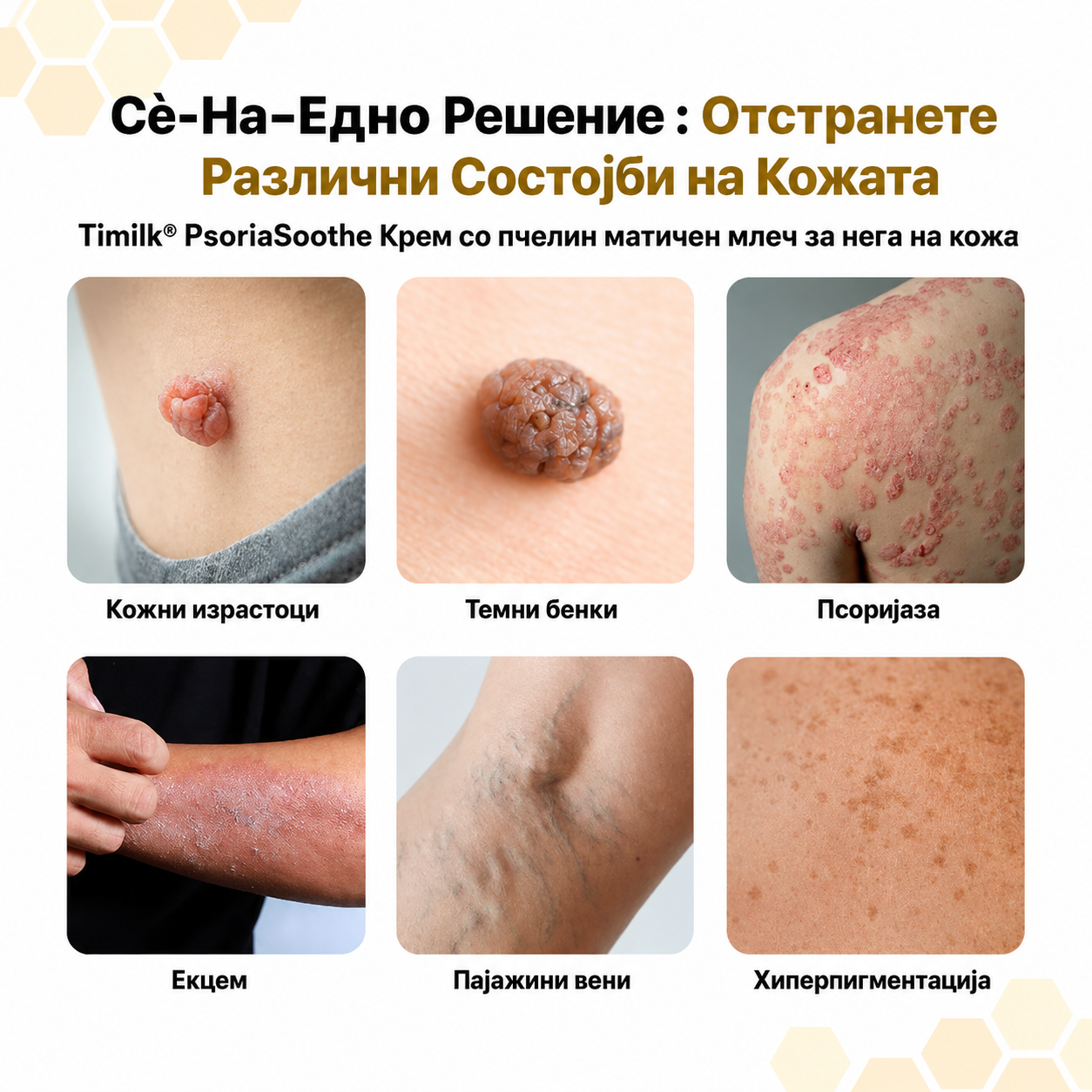 🌿 PsoriaSoothe – Крем за Нега на Кожа Склонa Кон Псоријаза, Егзема и Дерматитис