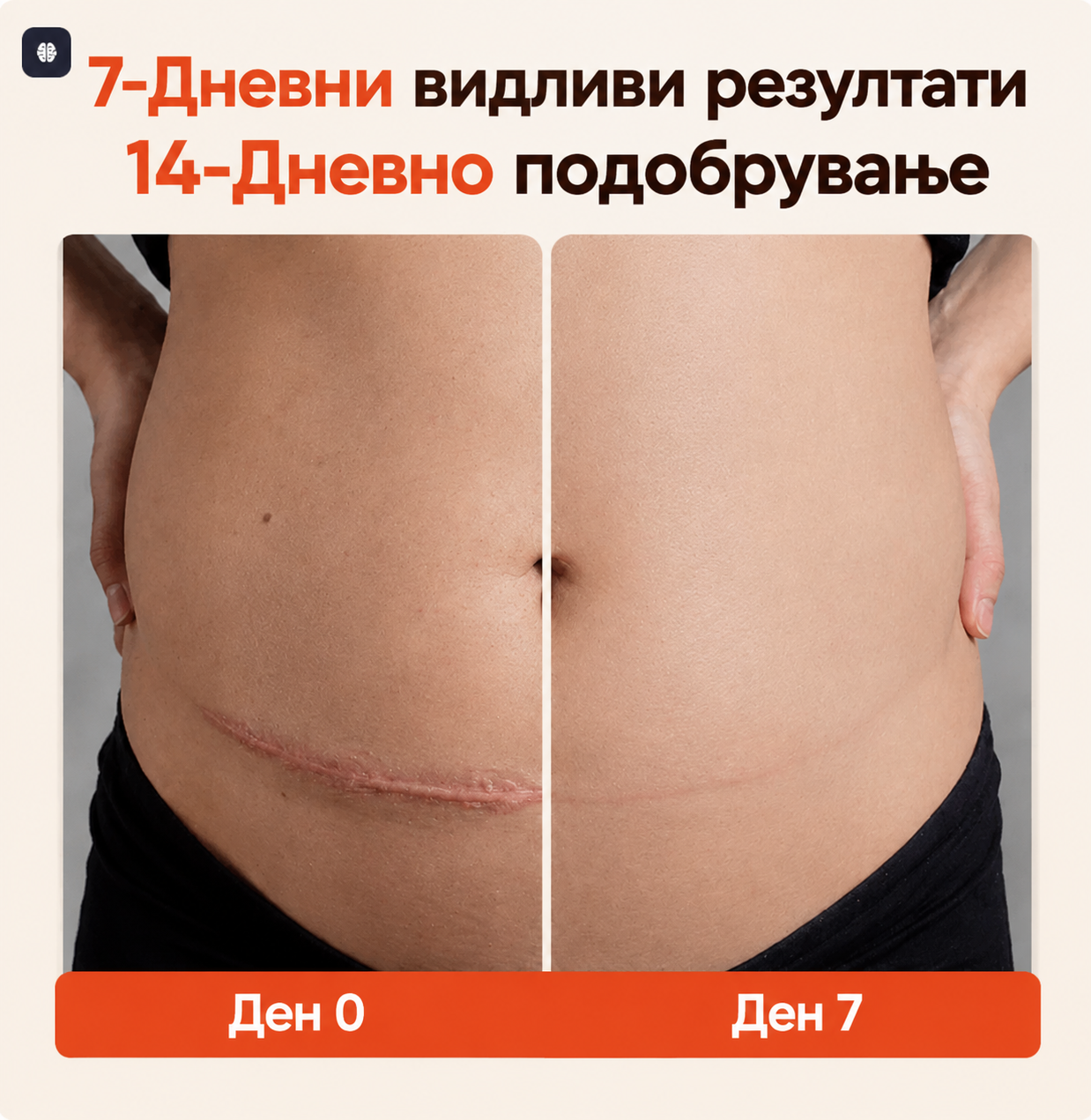 SilkStretch® Премиум Природно Масло против Стрии и Лузни