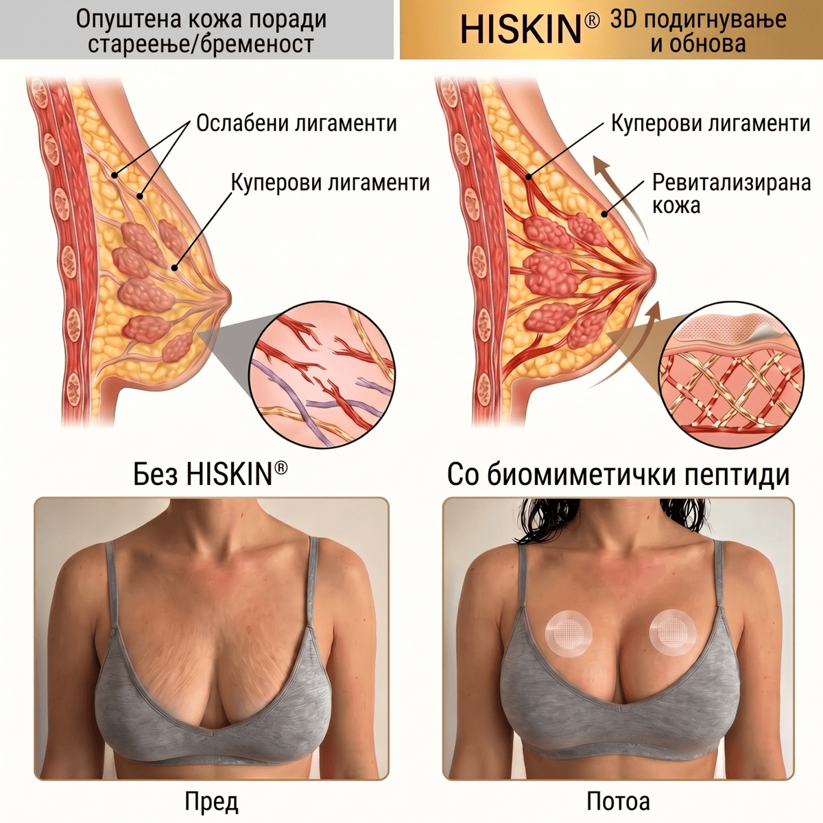 ❤️ Breast Firming 👩‍⚕️ HISKIN® – Нано-Микроиглични Фластери за Зацврстување и Подигнување на Градитеproduct_vendor#100% ЕФИКАСНО❤️ Breast Firming 👩‍⚕️ HISKIN® – Нано-Микроиглични Фластери за Зацврстување и Подигнување на Градите# - 100% ЕФИКАСНО