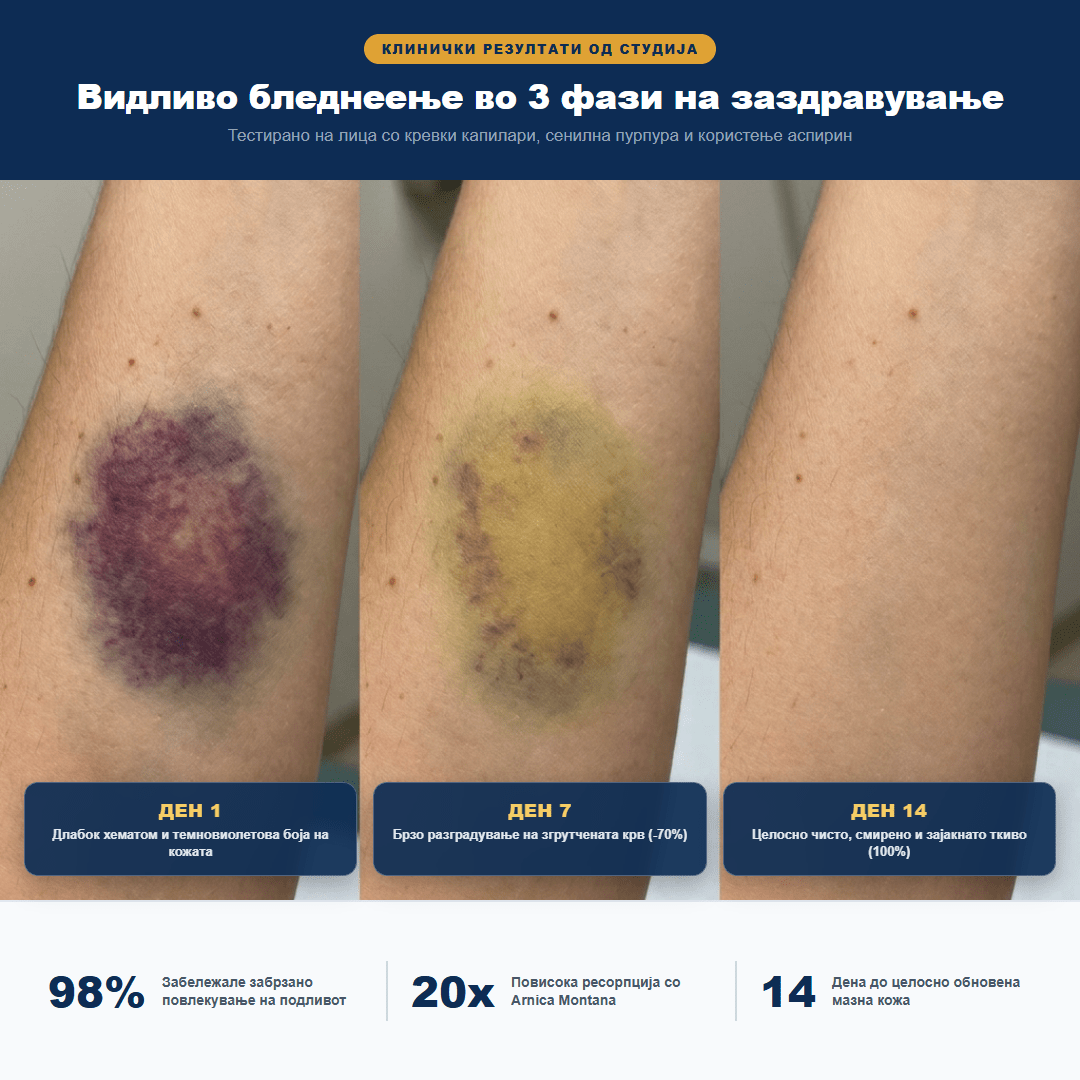 Biancat® ResiliVeil – Дерматолошка формула за обнова на кожната бариера и капиларитеproduct_vendor#100% ЕФИКАСНОRESILIVEIL-aukaBiancat® ResiliVeil – Дерматолошка формула за обнова на кожната бариера и капиларите# - 100% ЕФИКАСНО