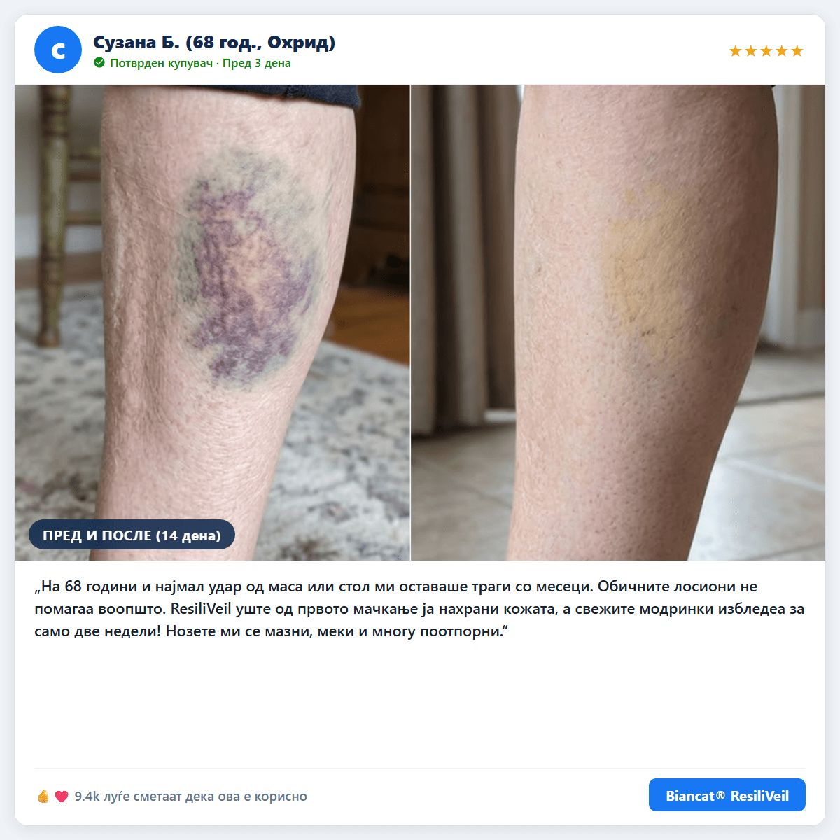 Biancat® ResiliVeil – Крем за изгледот на модринки и заштита на кожатаproduct_vendor#100% ЕФИКАСНОBiancat® ResiliVeil – Крем за изгледот на модринки и заштита на кожата# - 100% ЕФИКАСНО