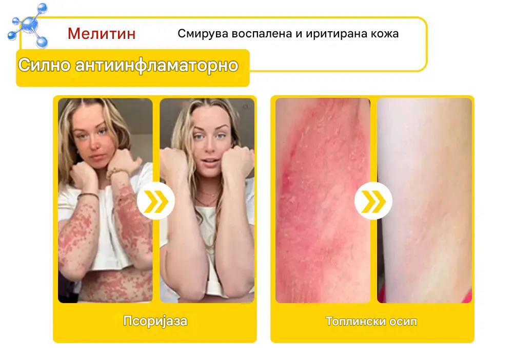 ⚕️𝐳𝐯𝐨𝐞𝐯𝐨® Спреј со Матичен Млеч за Кожа